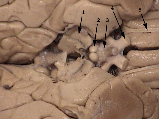 Mamillary Bodies