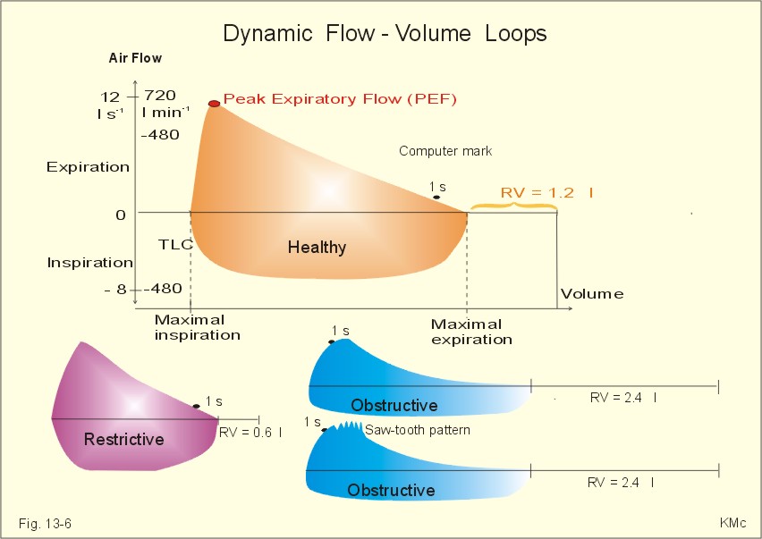 Flow Volume Loop